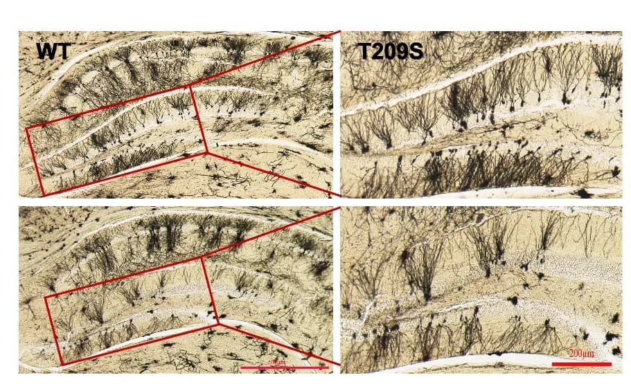 Open access visualization of Microscopy, Golgi Stain, Hippocampi