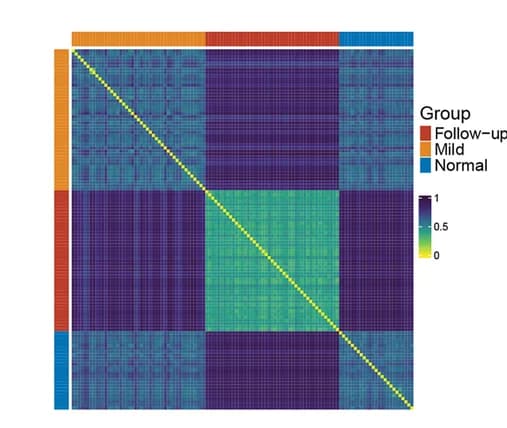 Open access visualization of Heatmap, Clustered, Jaccard distance, Microbial composition, Saliva samples