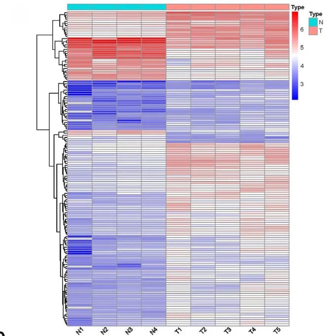 Open access visualization of Heatmap, Clustered, Differentially Expressed Proteins, Bile, CCA