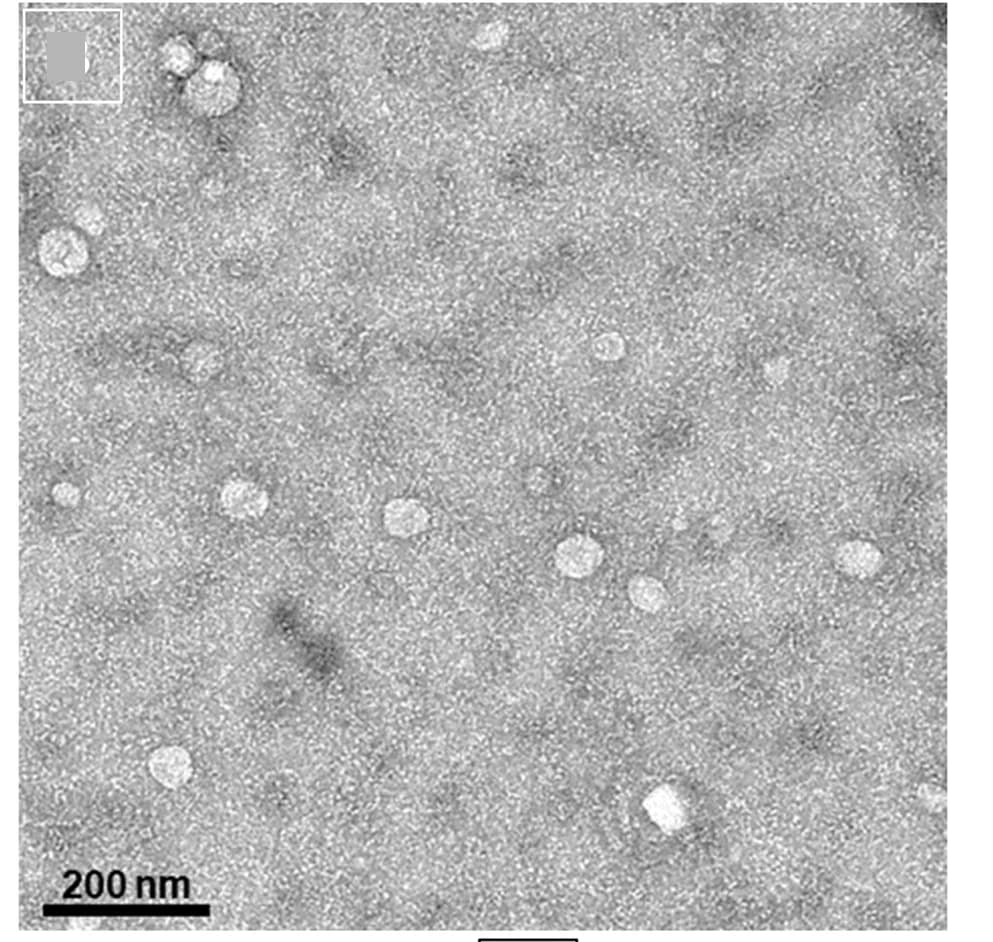 Open access visualization of Microscopy, Transmission Electron Microscopy, Salivary sEV, PD Patients