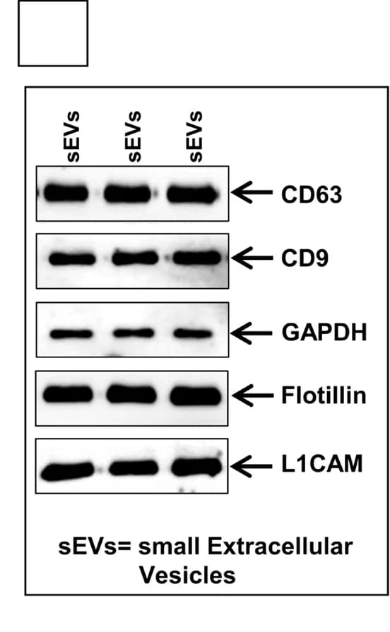 Open access visualization of Gel, Western-blot, CD63, CD9, Flotillin-1
