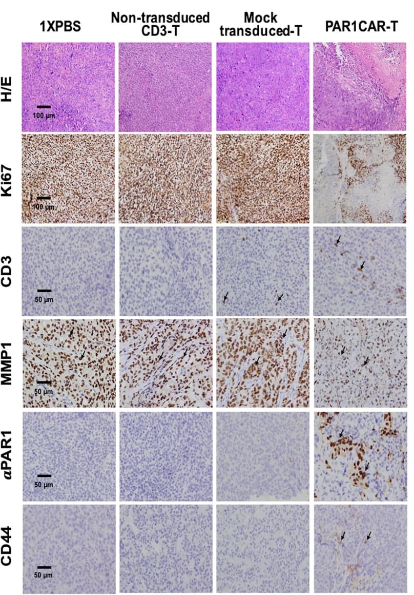 Open access visualization of Microscopy, Tumor Sections, Hematoxylin and Eosin Staining, Ki67, CD3