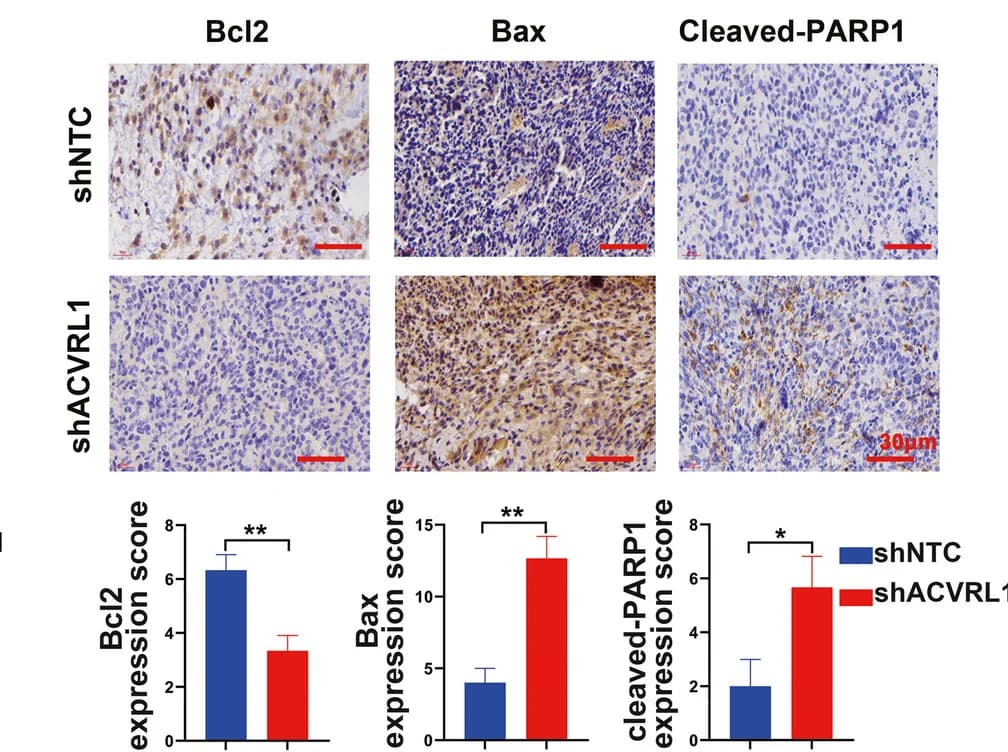 Open access visualization of Bar Plot, Microscopy, Error Bars, Tumor Tissue Sections, Xenografts