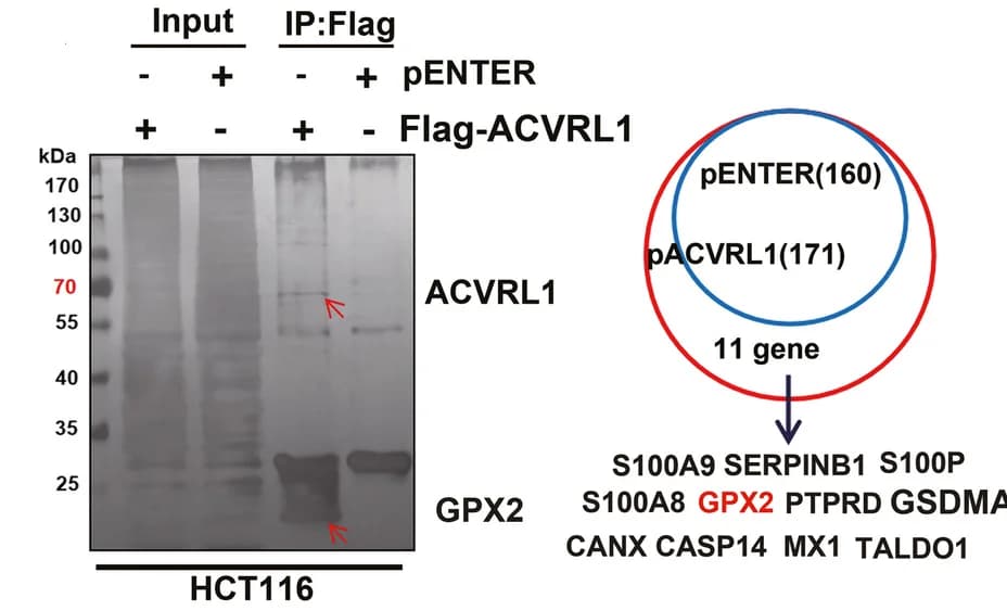 Open access visualization of Gel, Venn Diagram, HCT116 Cells, ACVRL1-Flag, pENTER