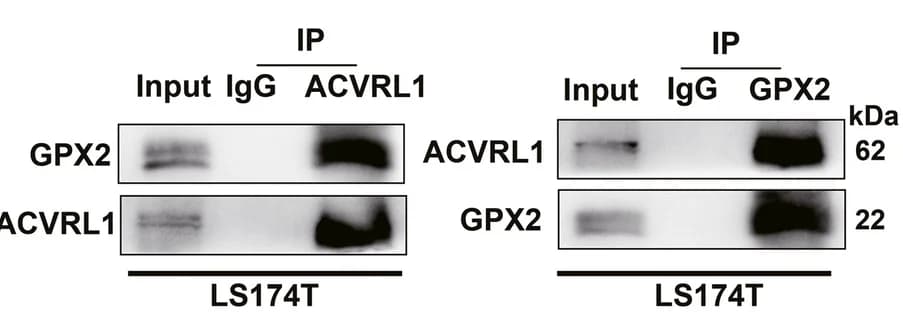 Open access visualization of Gel, Co-IP Assays, LS174T Cells, GPX2, ACVRL1