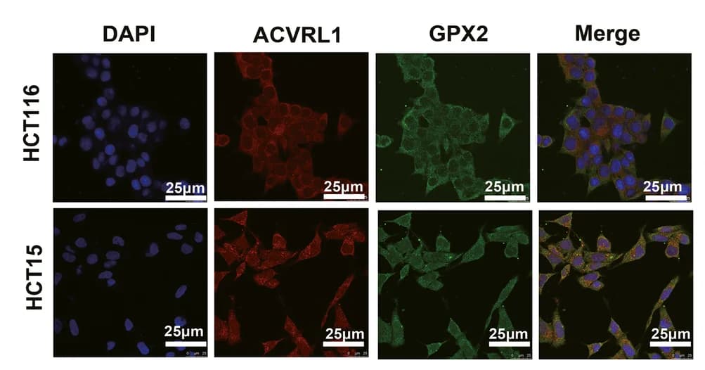 Open access visualization of Microscopy, Immunofluorescence, ACVRL1, GPX2, HCT15 Cells