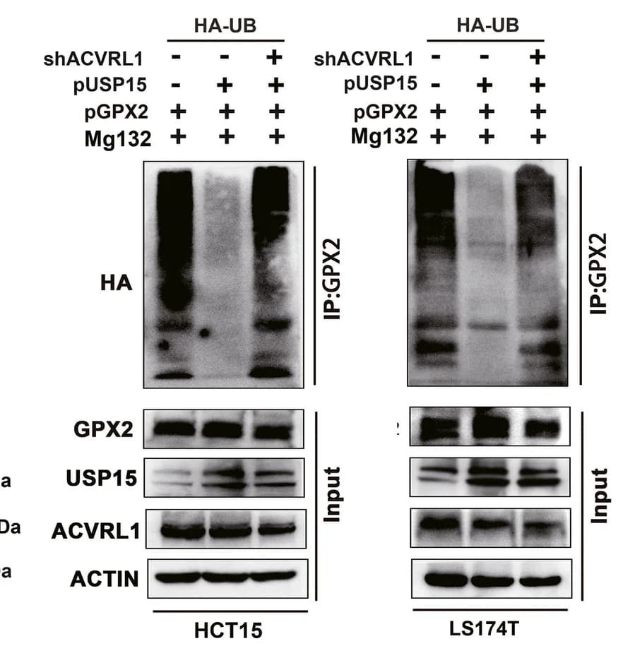 Open access visualization of Gel, Ubiquitination, GPX2, CRC Cells, USP15