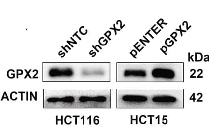 Open access visualization of Gel, shGPX2 plasmid, GPX2 overexpression plasmid, Western blot, qRT-PCR