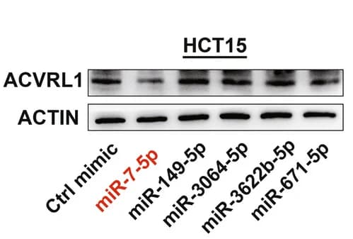 Open access visualization of Gel, HCT15 Cells, miRNA Mimics, miR-7-5p, ACVRL1