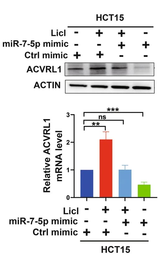 Open access visualization of Bar Plot, Error Bars, Photo, Gel, HCT15 Cells