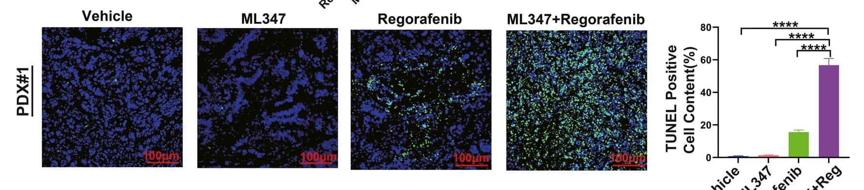 Open access visualization of Microscopy, Bar Plot, Error Bars, TUNEL Staining, Tumor Tissues