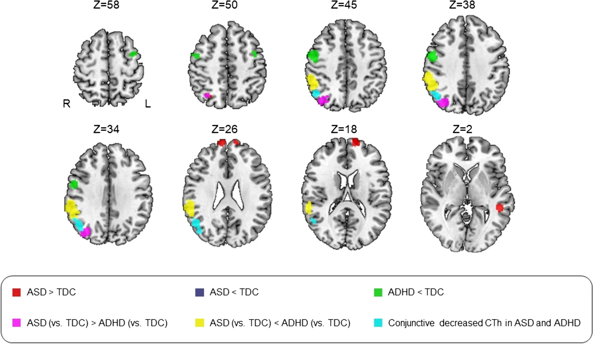 Open access visualization of Photo, Cortical Thickness, ASD, ADHD, SDM