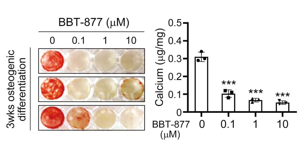 Open access visualization of Bar Plot, Error Bars, Photo, Alizarin Red Staining, Calcium Deposition