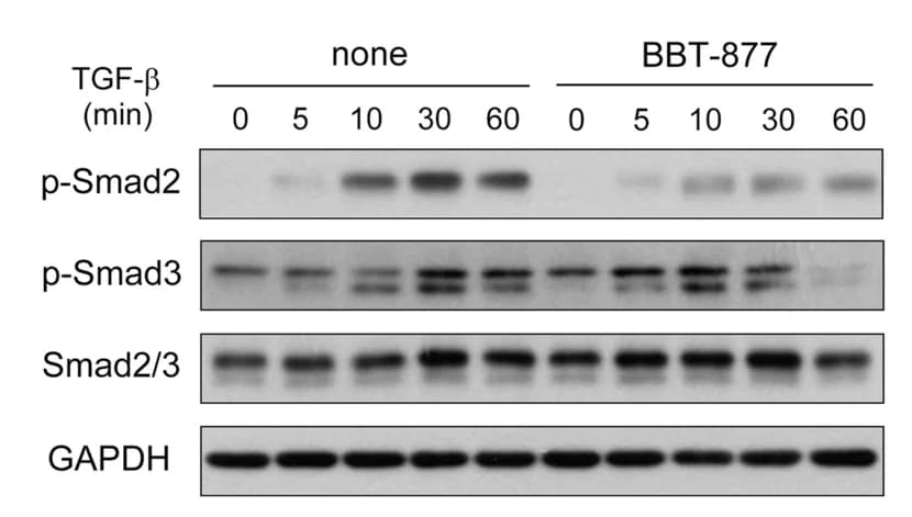 Open access visualization of Gel, Protein Levels, p-Smad2, p-Smad3, Smad2/3