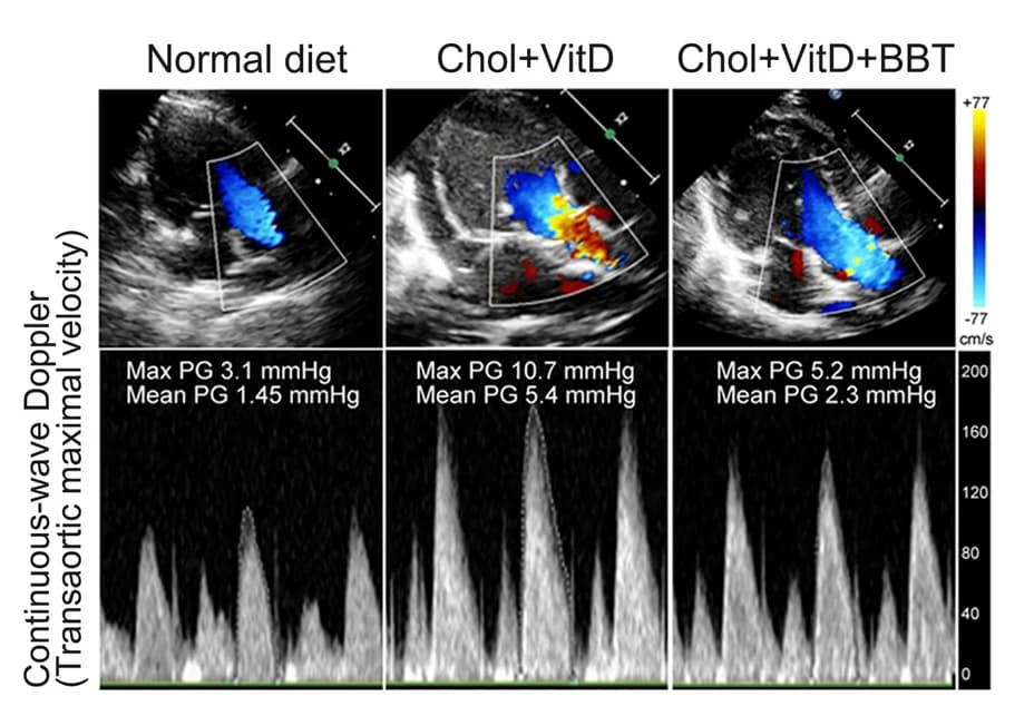 Open access visualization of Line Plot, Microscopy, Aortic Valve Area, AVA, Continuity Equation