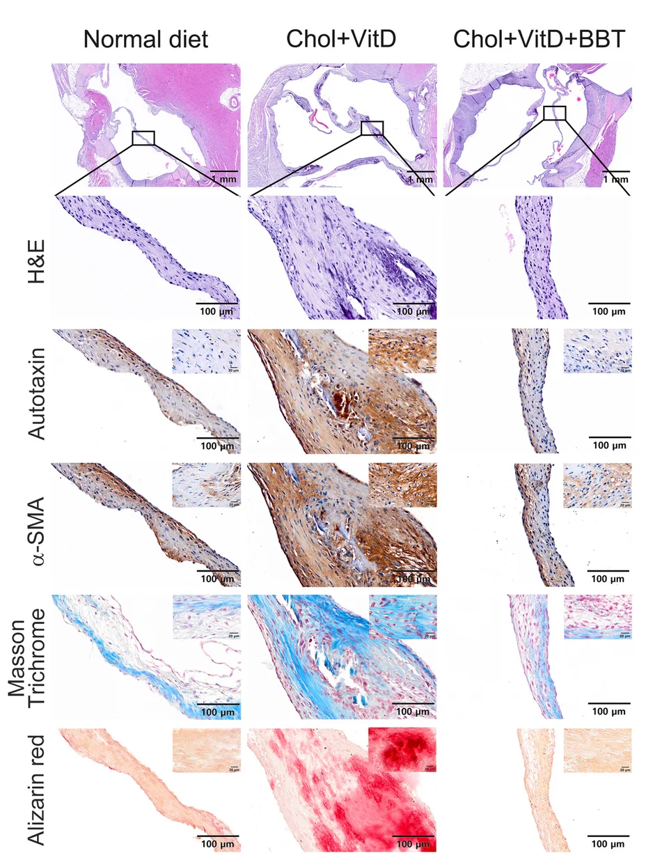 Open access visualization of Microscopy, Paraffin Sections, Aortic Valves, Rabbits, Hematoxylin and Eosin Staining