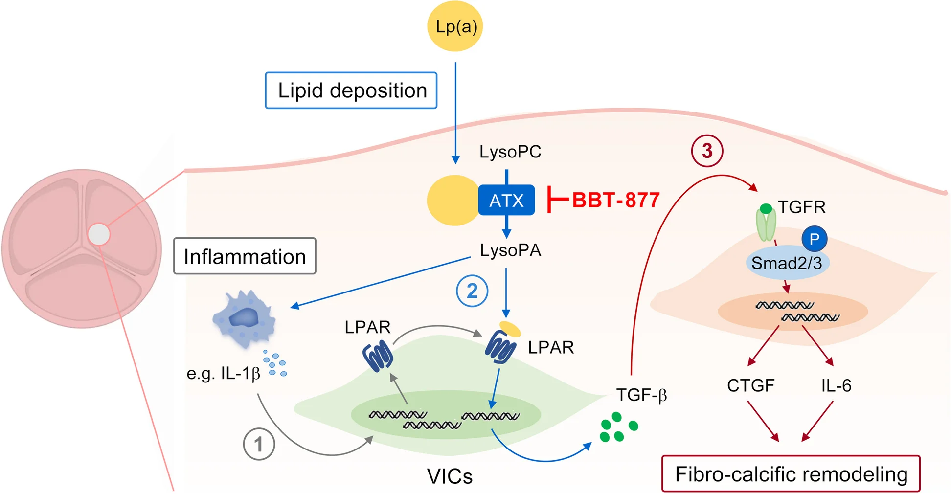 Open access visualization of Workflow, Flowchart, ATX Inhibition, FCAVD, Inflammatory Environment