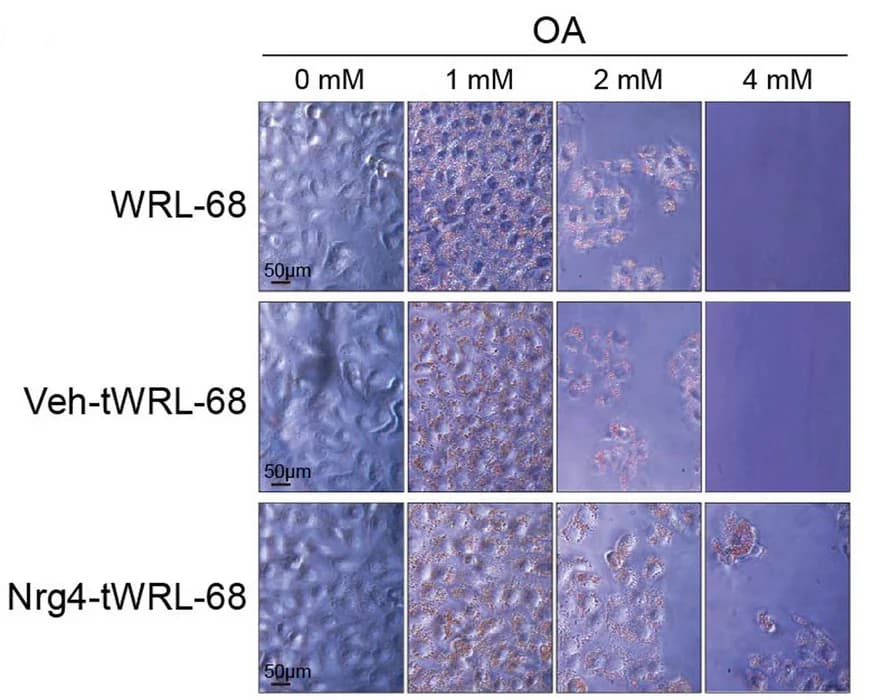 Open access visualization of Microscopy, Oil Red O Staining, Metabolic Status, Control Cells, Nrg4-Overexpressing Cells