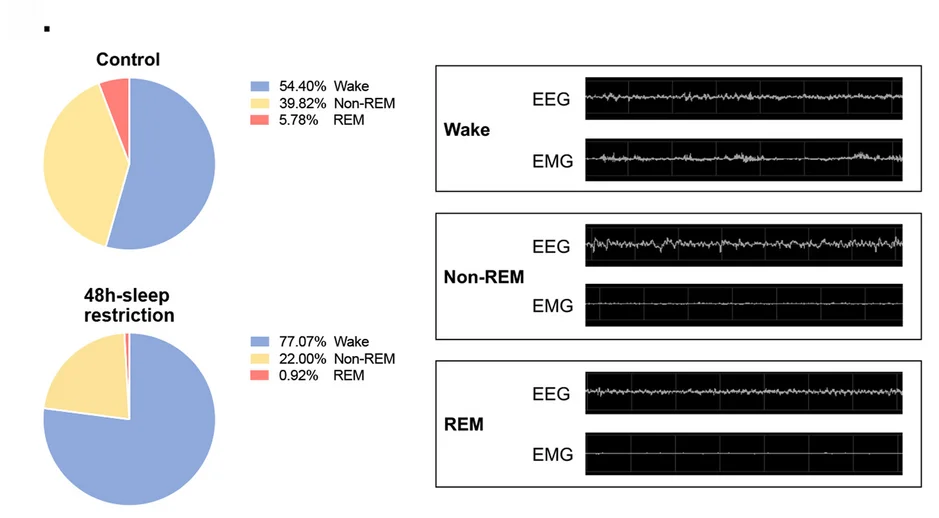 Open access visualization of Pie Chart, Line Plot, Sleep Composition, EEG, EMG