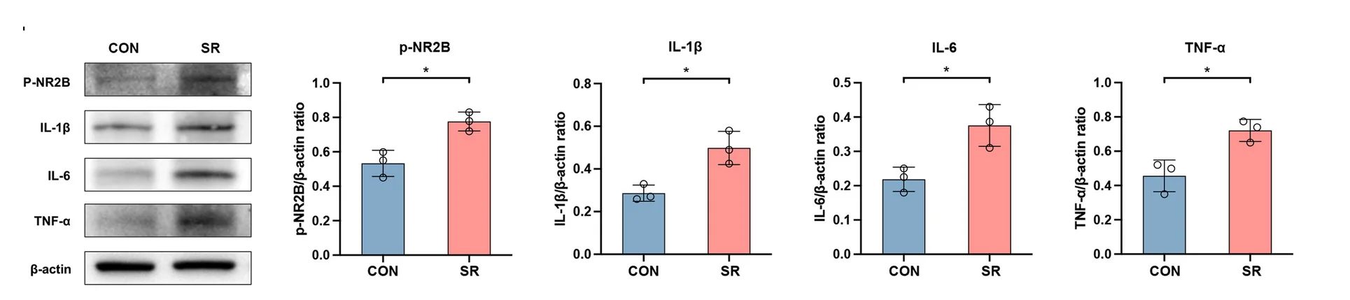 Open access visualization of Bar Plot, Error Bars, Photo, Gel, p-NR2B