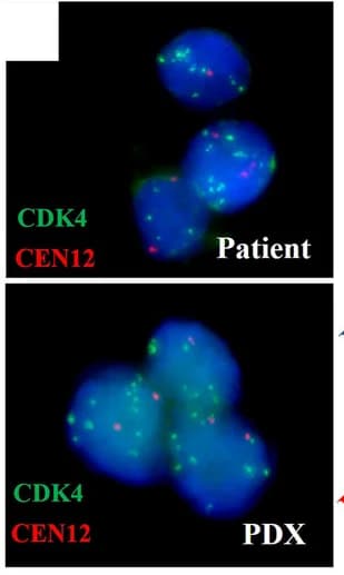 Open access visualization of Microscopy, Palbociclib, Dalpiciclib, CDK4, PDX