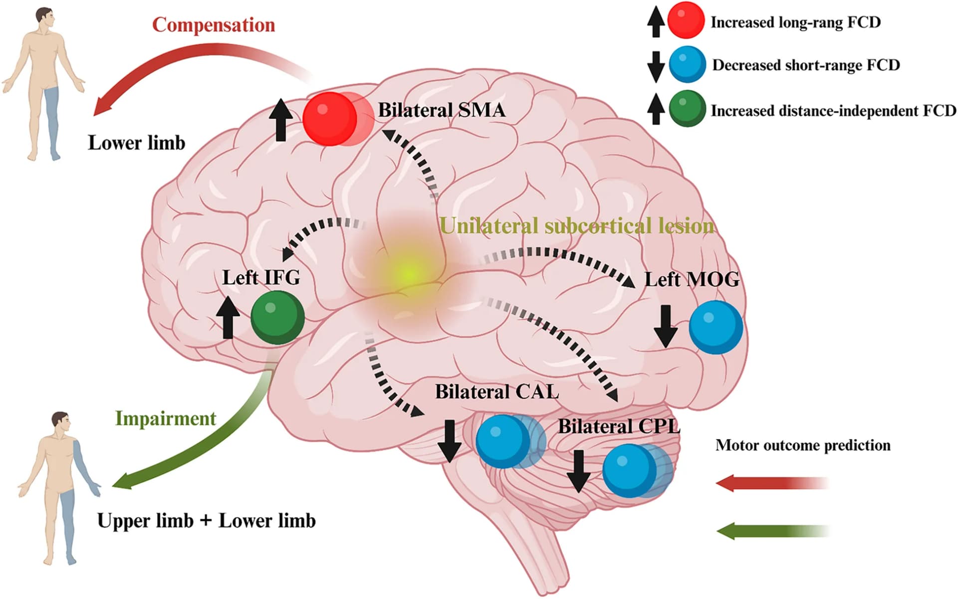 Open access visualization of Illustration, Workflow, Functional Connectivity Density, Supplementary Motor Area, Inferior Frontal Gyrus