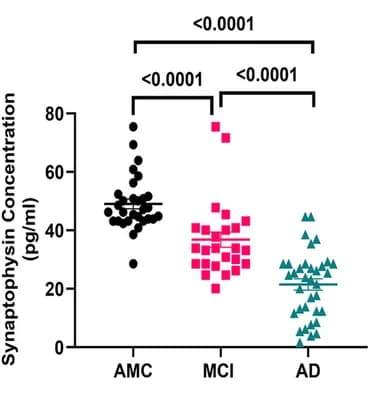 Open access visualization of Scatter Plot, Synaptophysin, Age-Matched Control, Mild Cognitive Impairment, Alzheimer’s Disease
