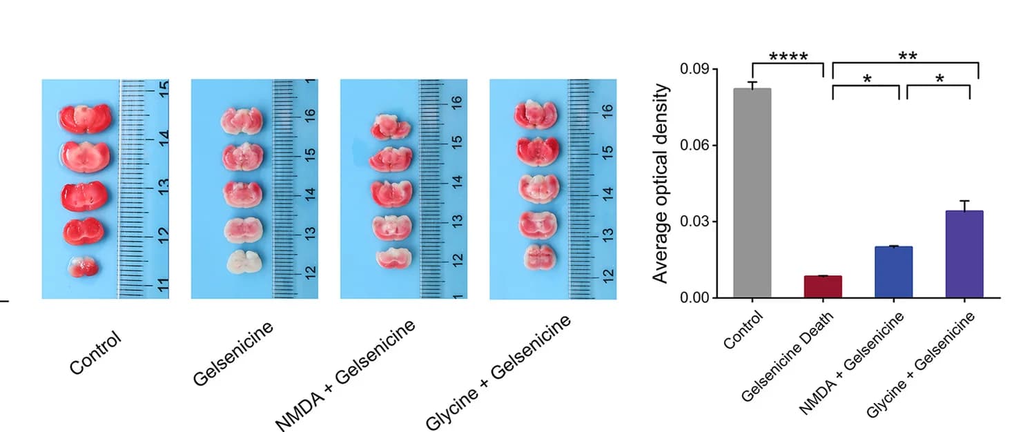 Open access visualization of Bar Plot, Error Bars, Microscopy, Photo, Brain Sections