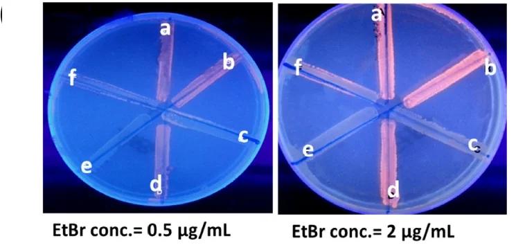Open access visualization of Gel, EtBr Efflux, EtBr Agar Cartwheel Method, Isolates, Tryptone Soya Agar Plates