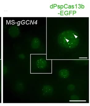 Open access visualization of Microscopy, Chemically Modified gRNA, CRISPR-dCas13, RNA Labeling, CRISPR-dPspCas13b System