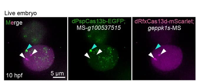 Open access visualization of Microscopy, 100537515 mRNA, eppk1 mRNA, dPspCas13b System, dRfxCas13d System
