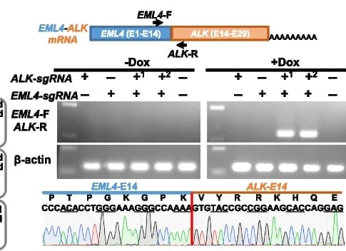 Open access visualization of Gel, RT-PCR Analysis, Sanger Sequencing, EML4-ALK Fusion Transcripts, Chromosomal Inversion