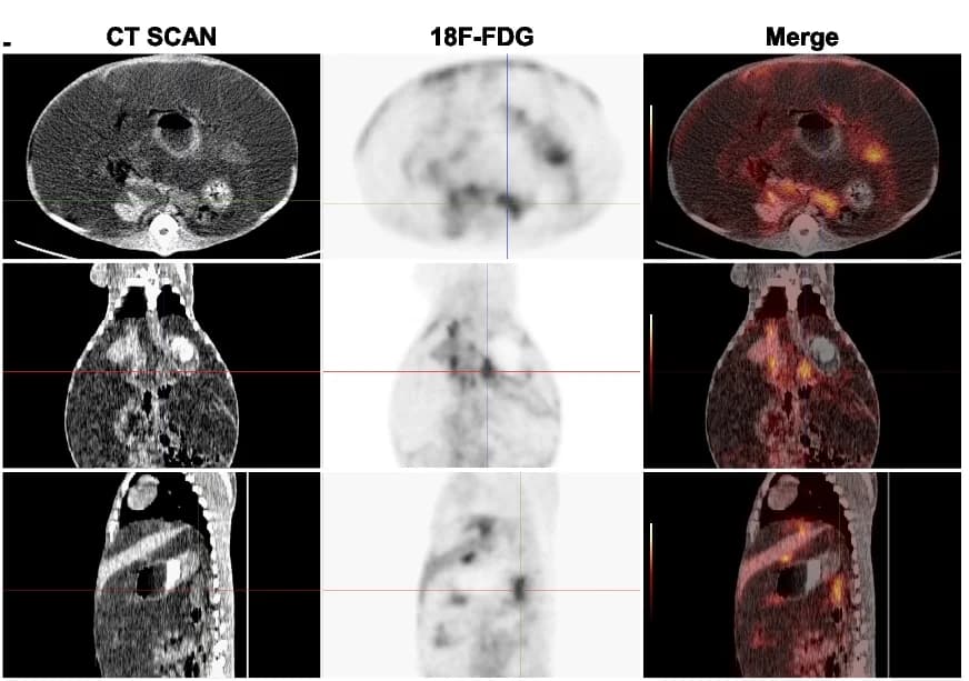 Open access visualization of Microscopy, AAV Injection, PET-CT Imaging, AAV6-PKL, DIC Pig