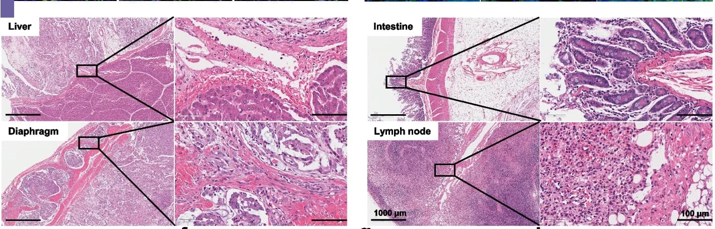 Open access visualization of Microscopy, H&E Staining, Metastatic Organs, Liver, Intestine