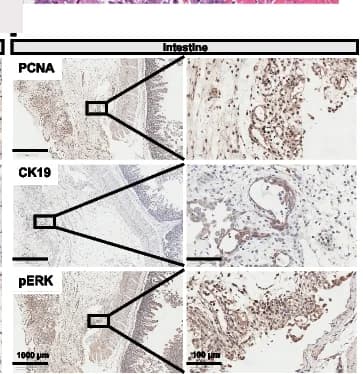 Open access visualization of Microscopy, IHC Staining, Intestine, PCNA, CK19