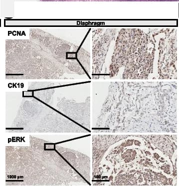 Open access visualization of Microscopy, IHC Staining, Diaphragm, PCNA, CK19