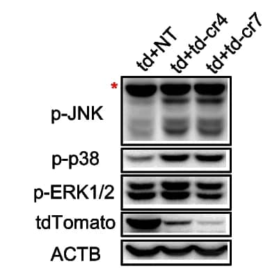 Open access visualization of Gel, Western Blot, Phosphorylation, p38, JNK
