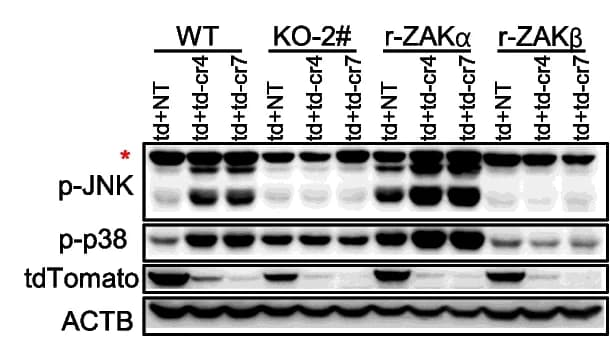 Open access visualization of Gel, Western Blot, Phosphorylation, p38, JNK