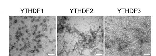 Open access visualization of Microscopy, Higher-order structures, LCDs, YTHDFs, Electron microscopy
