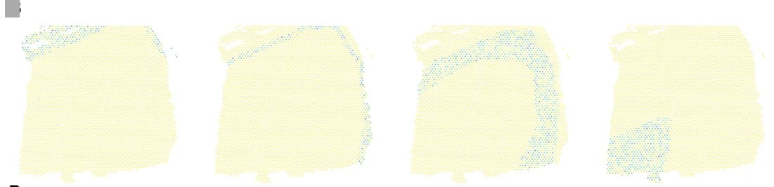 Open access visualization of Geo Map, DLPFC, Gene Expression, Spatial Pattern, Layered Structure