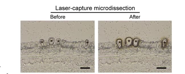 Open access visualization of Microscopy, Photo, Laser-Capture Microdissection, LCM, Fiber Cells