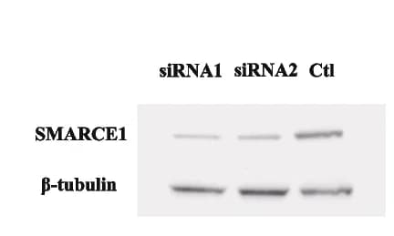 Open access visualization of Gel, Immunoblotting, SMARCE1, Caco2 Cells, Control Group
