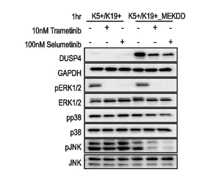 Open access visualization of Gel, Phosphorylation, ERK, JNK, p38