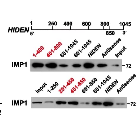 Open access visualization of Gel, IMP1 Binding Region, HIDEN, 293 T Cells, RNA Pulldown