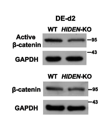 Open access visualization of Gel, HIDEN Knockout, Beta-catenin, Western Blot, DE Differentiation