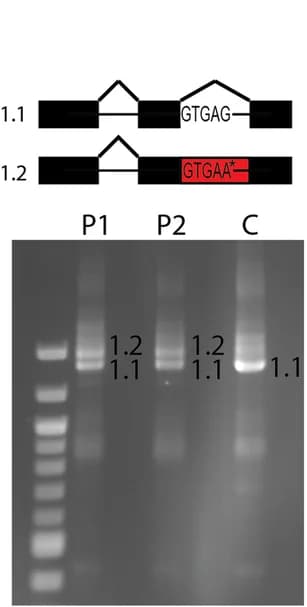 Open access visualization of Gel, Illustration, Splice Altering Variants, PKD1, Introme