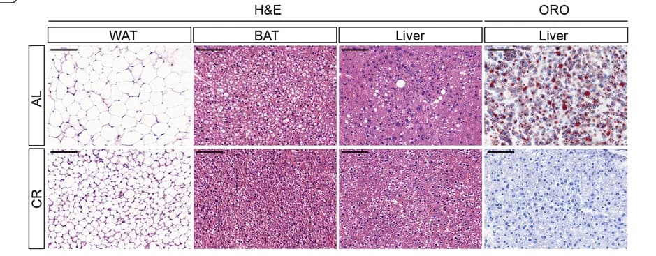 Open access visualization of Microscopy, Hematoxylin and Eosin Staining, Adipose Tissue, Liver, Brown Adipose Tissue