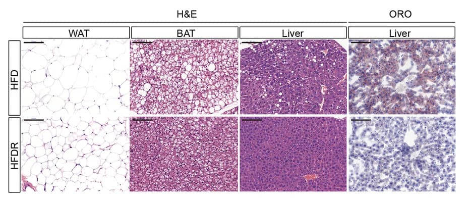 Open access visualization of Microscopy, H&E Staining, Adipose Tissue, Liver, Oil Red O Staining