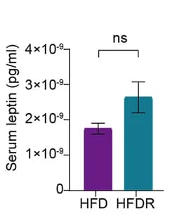 Open access visualization of Bar Plot, Error Bars, Serum Leptin, Male Mice