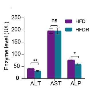 Open access visualization of Bar Plot, Error Bars, Clustered, Serum ALT, Serum AST